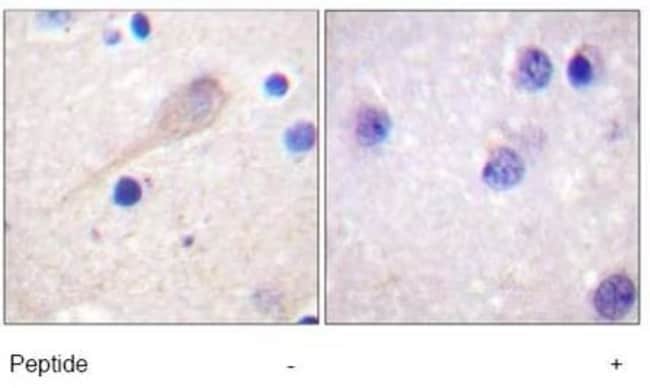 1 ML Parkin Rabbit polyclonal antibody I
