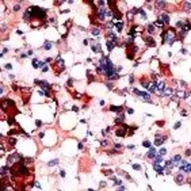 1 ML TSH, Rabbit Polyclonal Antibody IgG