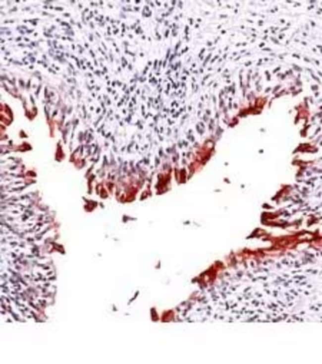 500uL Polyclonal antibody, uroplakin lll