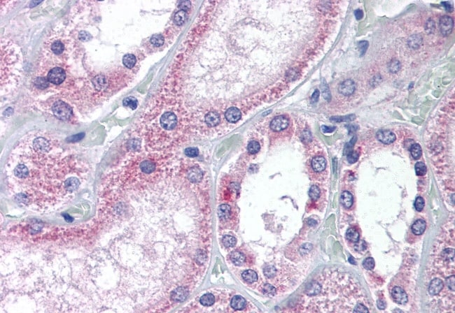 AADAT POLYCLONAL ANTIBODY, 50 µG
