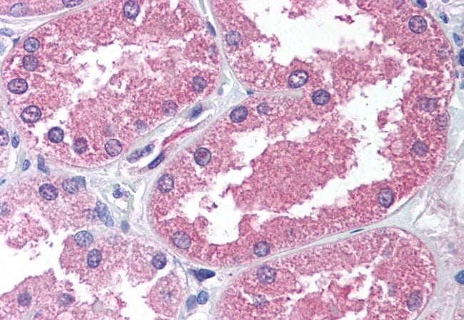 AADAT POLYCLONAL ANTIBODY, 50 µG