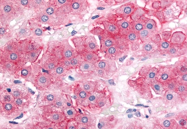 ABCB1/P GLYCOPROTEIN POLYCLONAL ANTIBODY