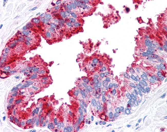 ADAM20 POLYCLONAL ANTIBODY, 50 µG