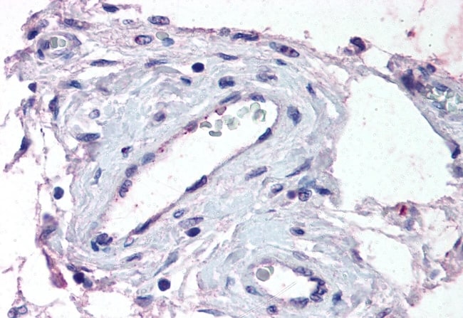 ADAMTS1 POLYCLONAL ANTIBODY, 50 µG