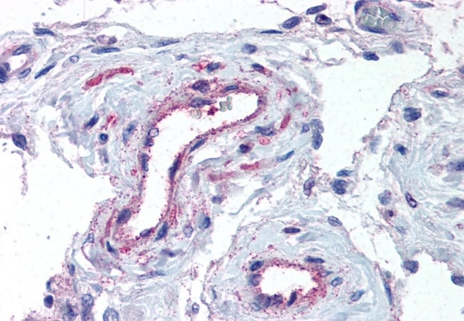 ADAMTS1 POLYCLONAL ANTIBODY, 50 µG