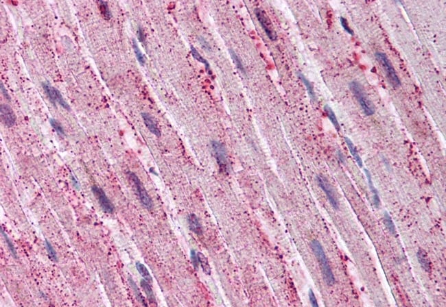 ADAMTS4 POLYCLONAL ANTIBODY, 50 µG
