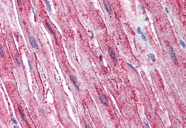 ADAMTS4 POLYCLONAL ANTIBODY, 50 µG