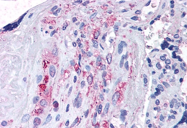 ADAMTS5 POLYCLONAL ANTIBODY, 50 µG