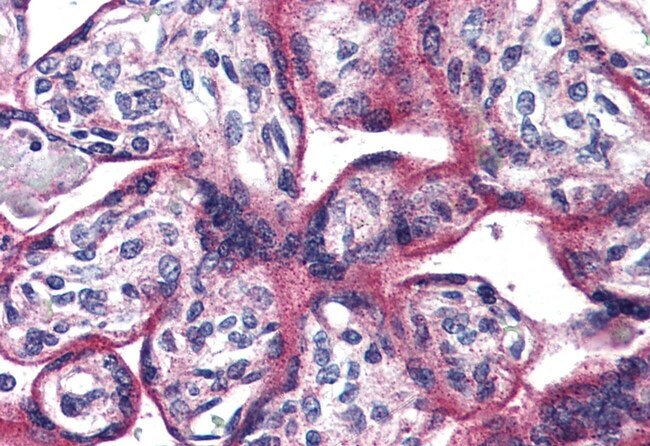 ADCYAP1R1 POLYCLONAL ANTIBODY, 50 µG