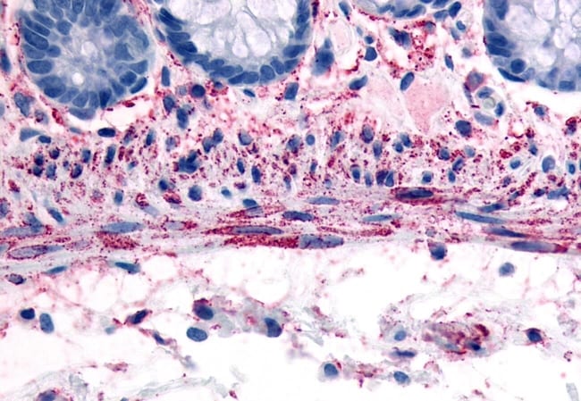 ADRA1B POLYCLONAL ANTIBODY, 50 µG