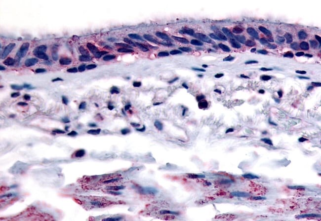 AHR POLYCLONAL ANTIBODY, 50 µG