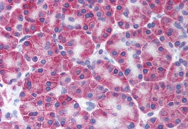 50UL KCNN4/KCa3.1, N-TERM, Antibody