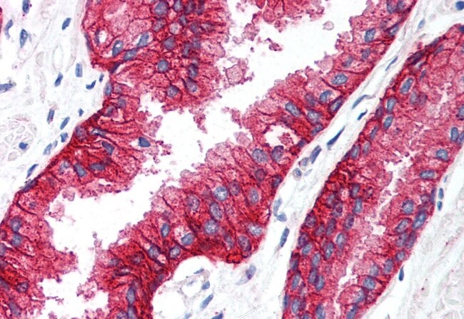 50UG KCNN4/KCA3.1, C-TERM, ANTIBODY