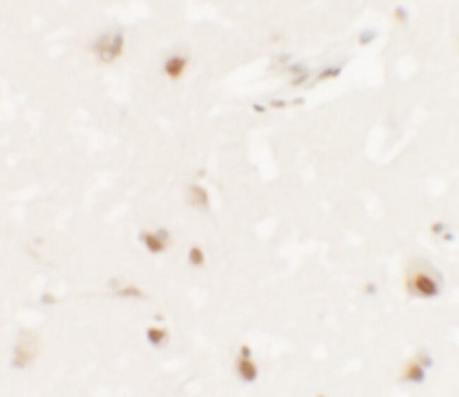 100 UG SHANK3 Polyclonal Antibody