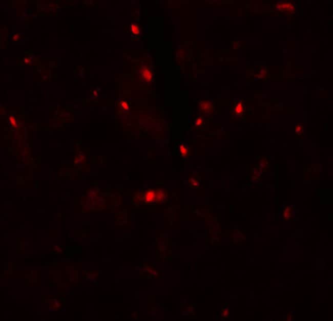 100UG SLC27A6 Antibody isotype IgG