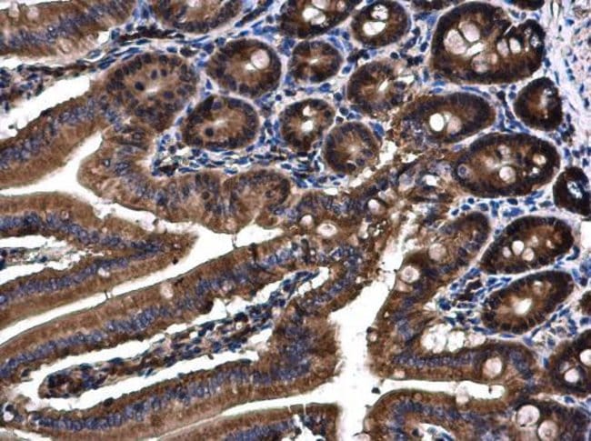 100UG Angiopoietin 4 Antibody