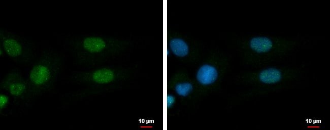 ADARB1 Rabbit anti-Human, Polyclonal iso