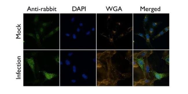 100UL Polyclonal Antibody, Influenza A V