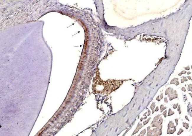 100UL Influenza A H3N2 HA Antibody