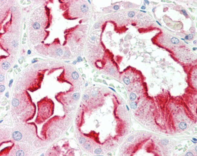 100 UG Apolipoprotein D Antibody