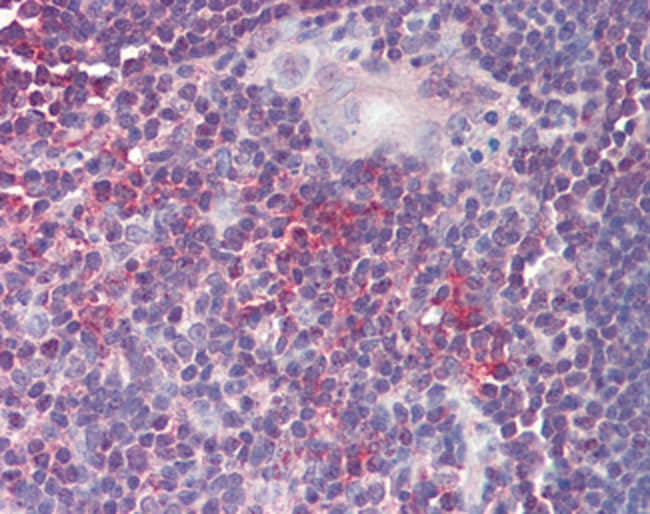 100 UG ARF4 Antibody