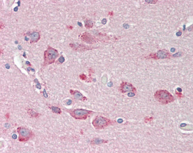100 UG BMP-1 Antibody