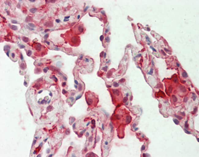 100 UG CAPG Antibody