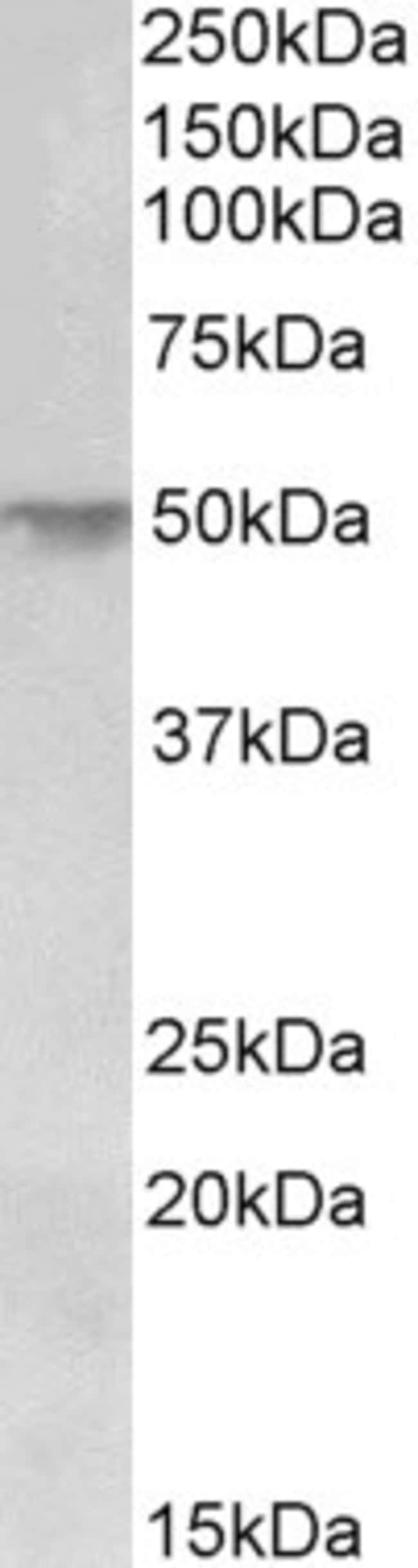 100 UG CDSN / Corneodesmosin Antibody