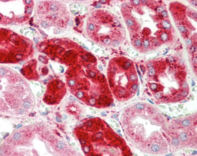 100 UG Cathepsin C / CTSC Antibody