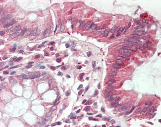 100 UG CLIC1 / NCC27 Antibody