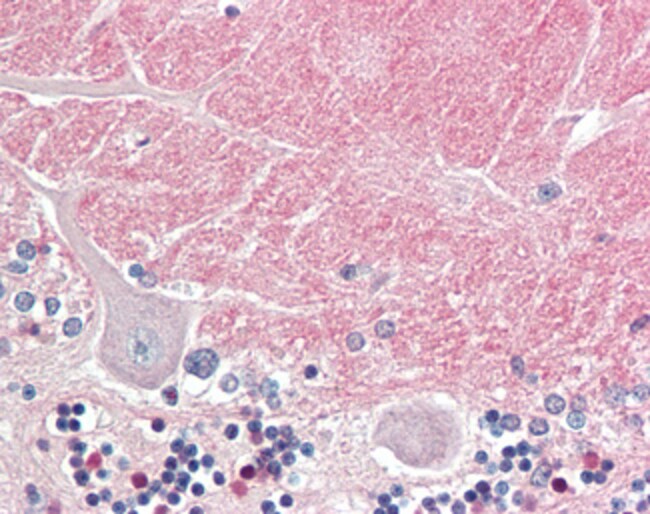 100 UG Contactin 1 / CNTN1 Antibody