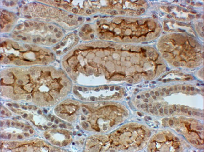 100 UG COL4A3 Antibody