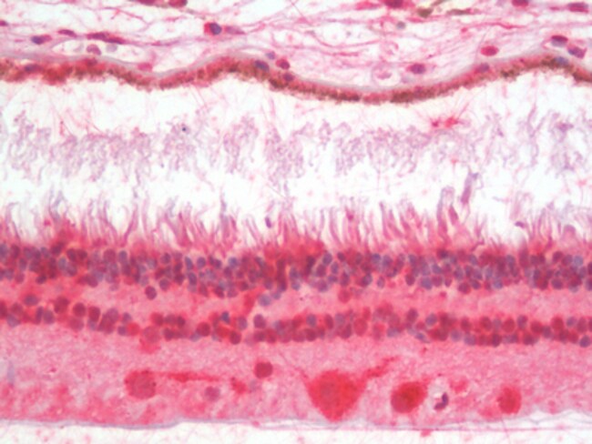 100 UG CRX / Cone-rod Homeobox Antibody