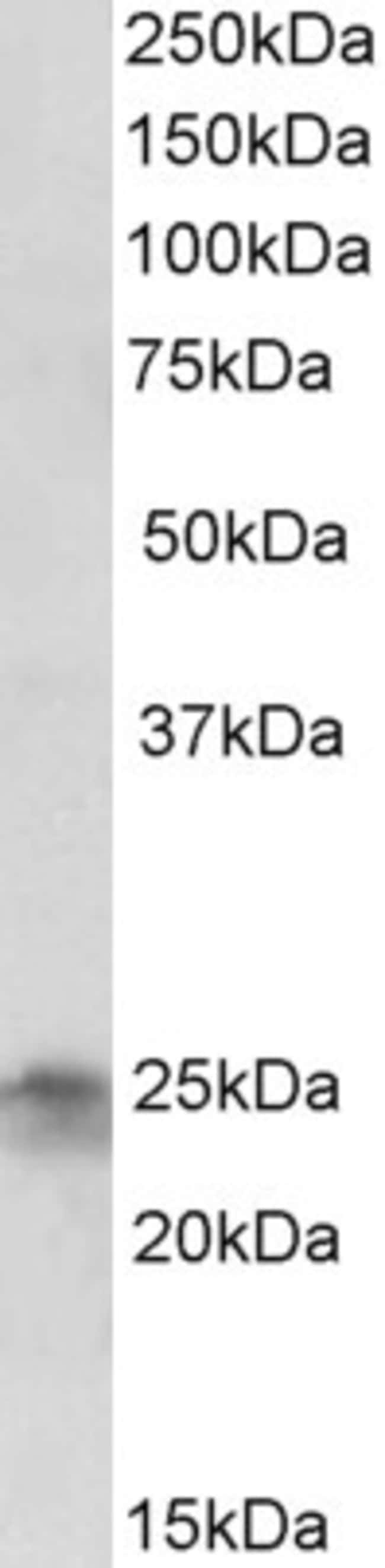 100 UG FGF8 / Fibroblast growth factor 8