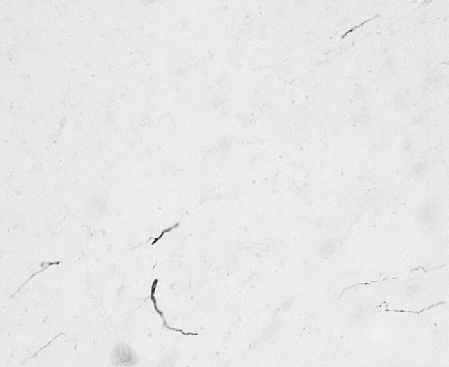 100 UG FGF14 / Fibroblast growth factor