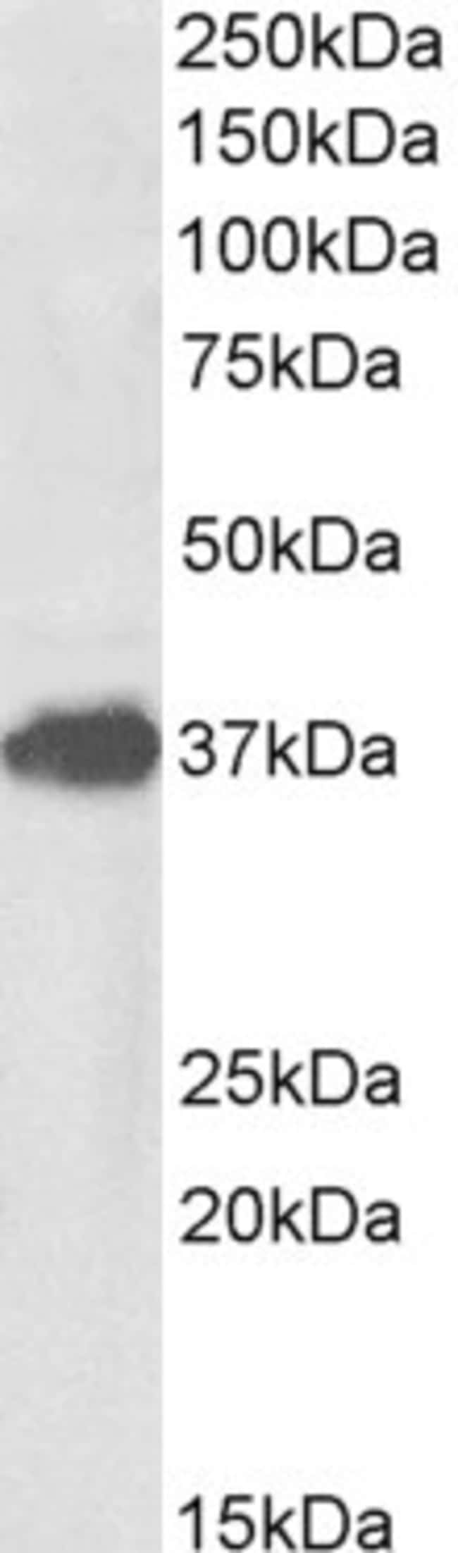 100 UG FOXF1 Antibody