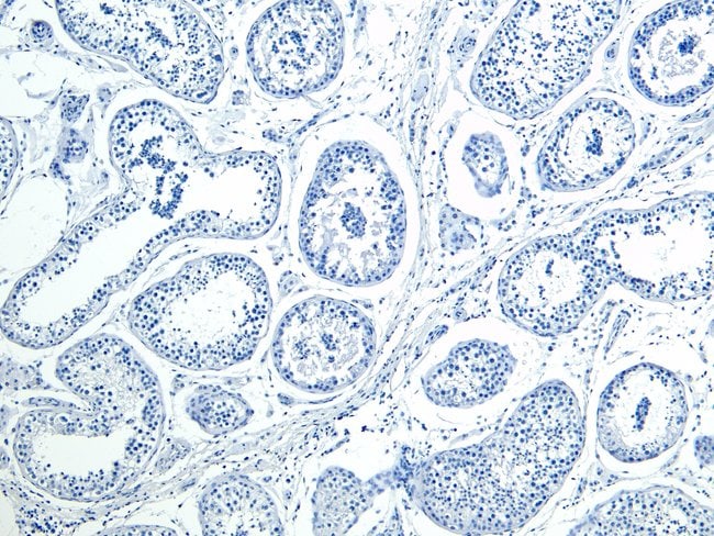 100 UG HOXA10 Antibody