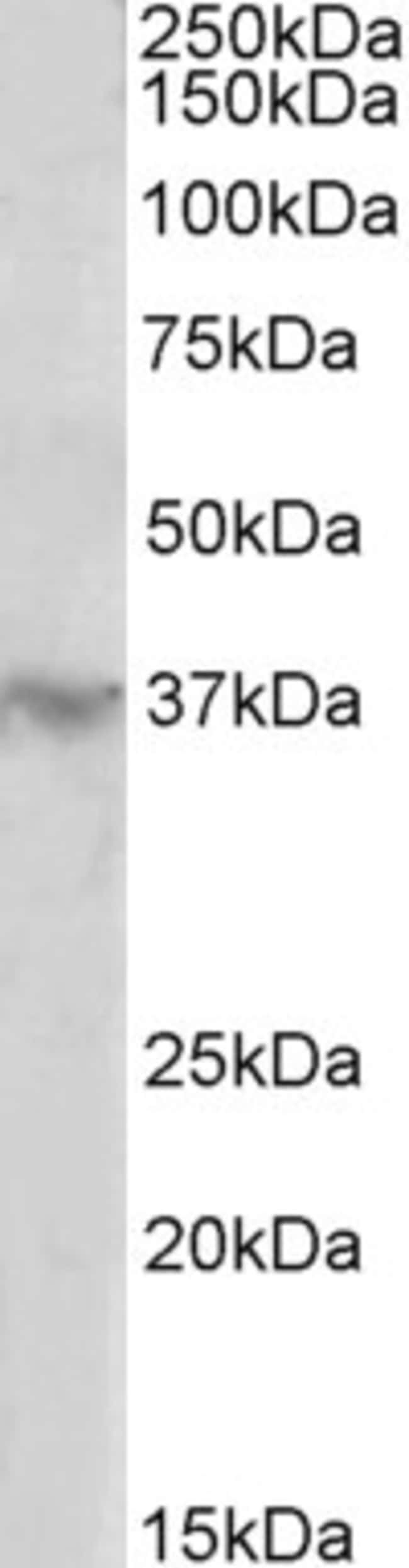 100 UG HOXD12 Antibody
