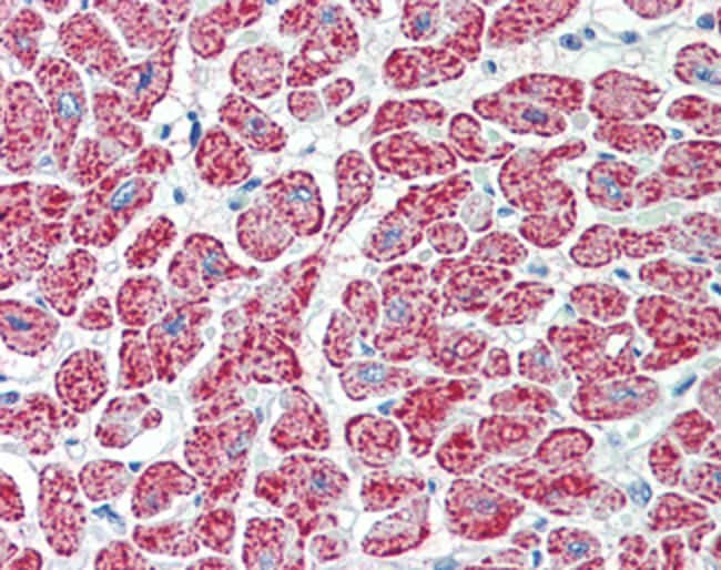 100 UG NDUFA7 Antibody