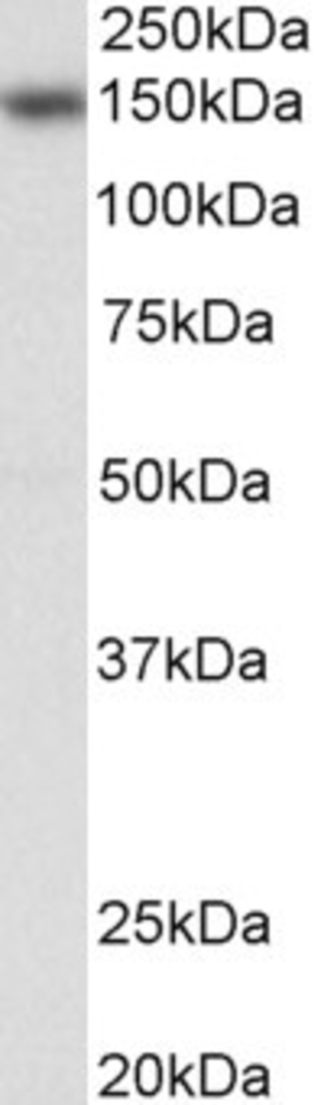 100 UG NFATC3 / NFAT4 Antibody