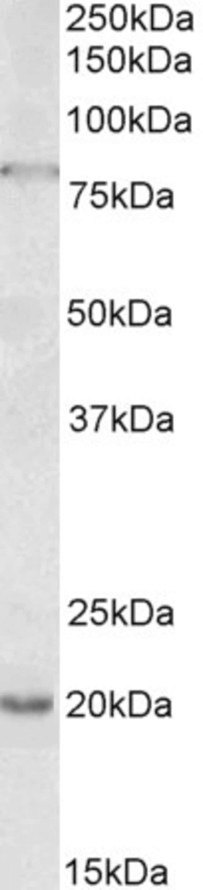100 UG OAS2 Antibody