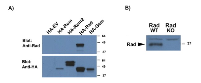 100 UG RAD1 / RRAD Antibody
