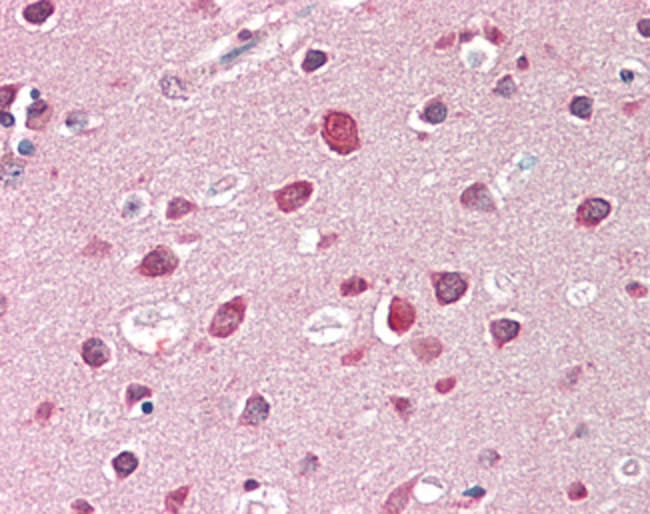 100 UG Endophilin-A1 / SH3GL2 Antibody