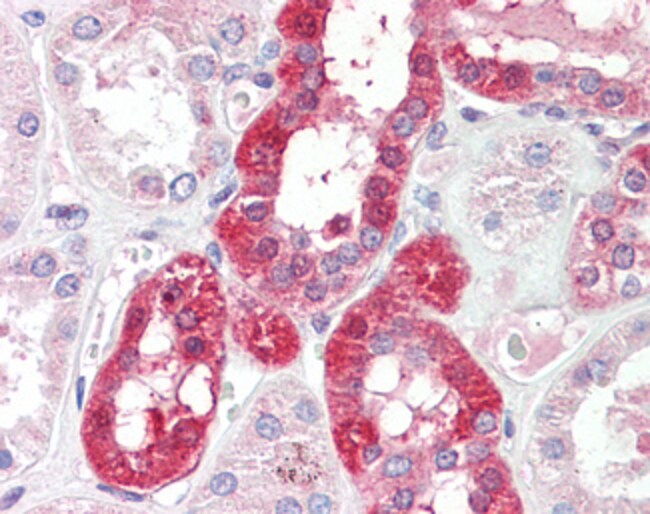 100 UG SLC6A8 Antibody