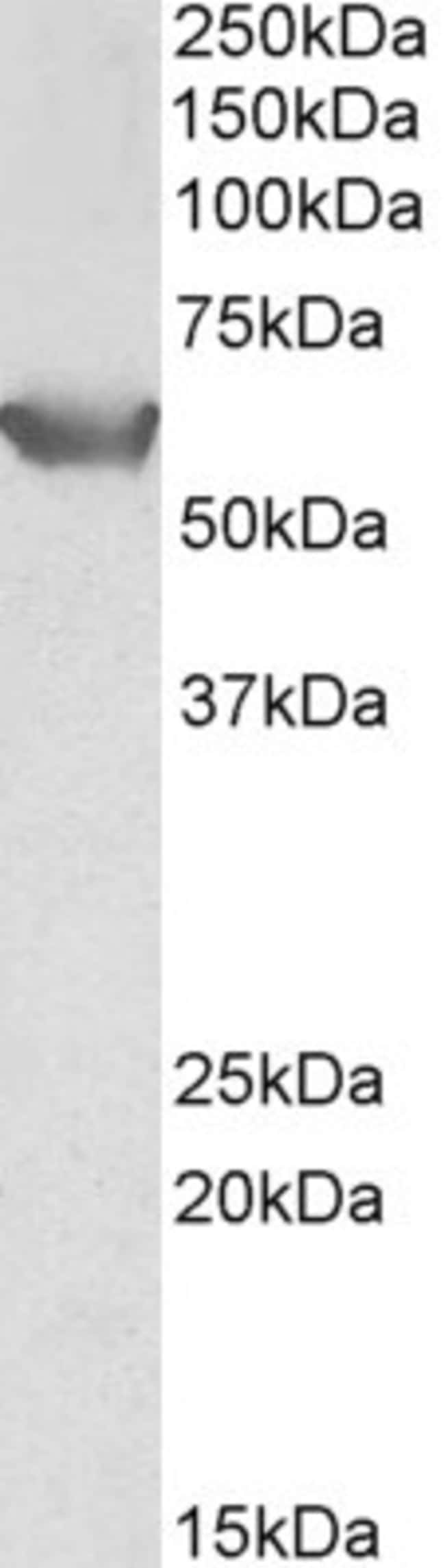 100 UG SLC22A3 Antibody