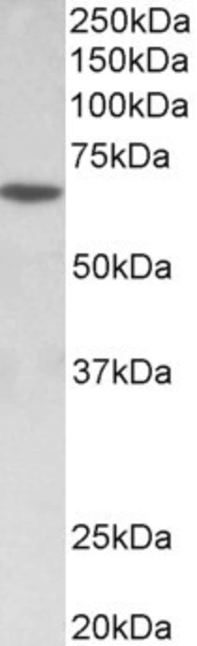 100 UG SOX11 Antibody