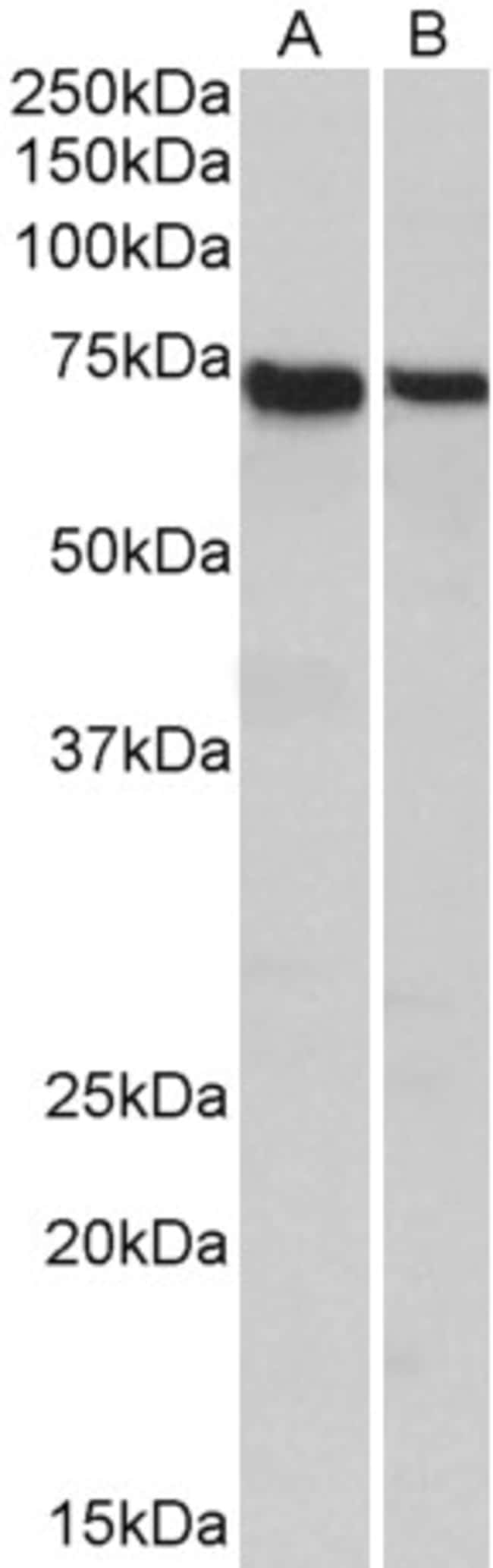 100 UG STXBP3 / Munc18c Antibody