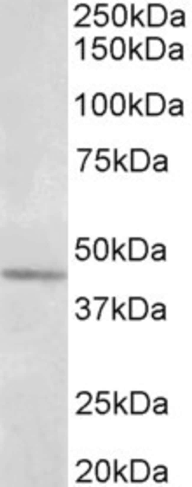 100 UG Synaptotagmin 5 Antibody