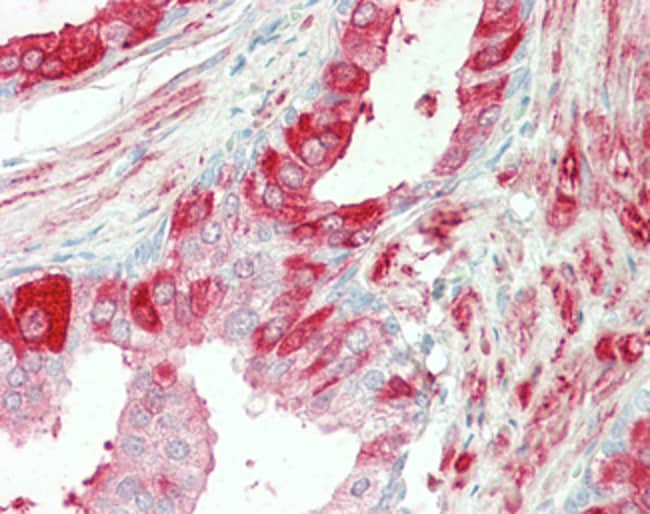 100 UG Transglutaminase 4 Antibody