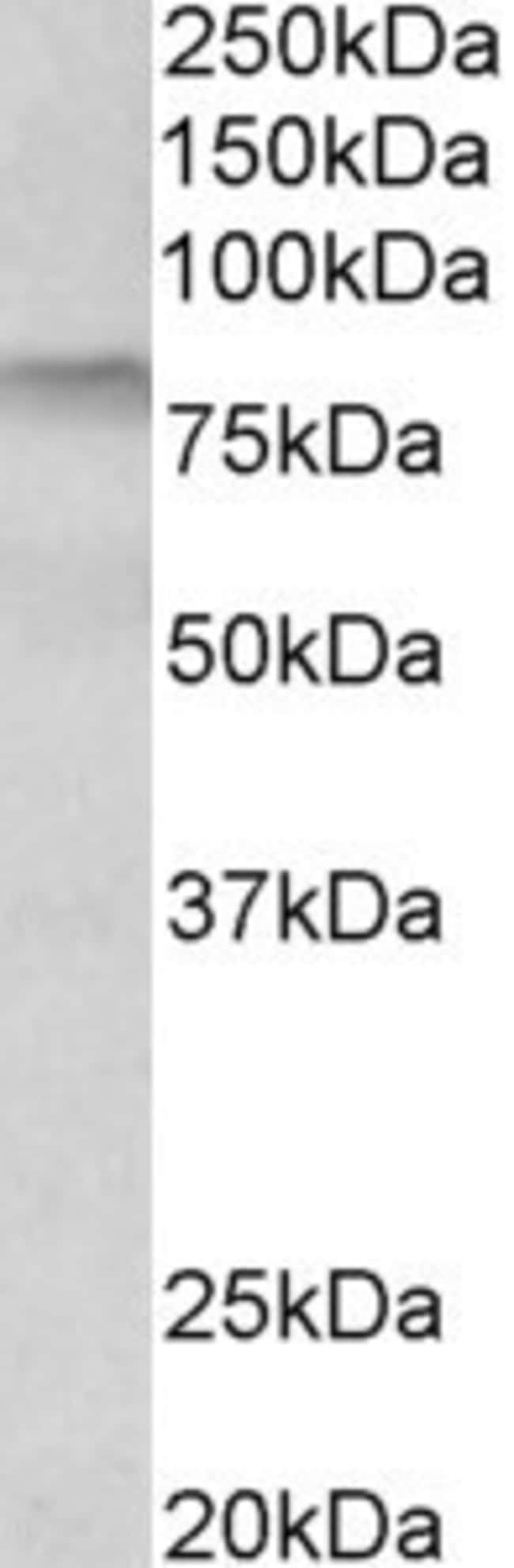100 UG Transglutaminase 3 Antibody
